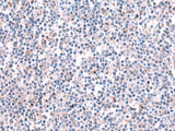 KCNK10 Polyclonal Antibody Reactivity Human