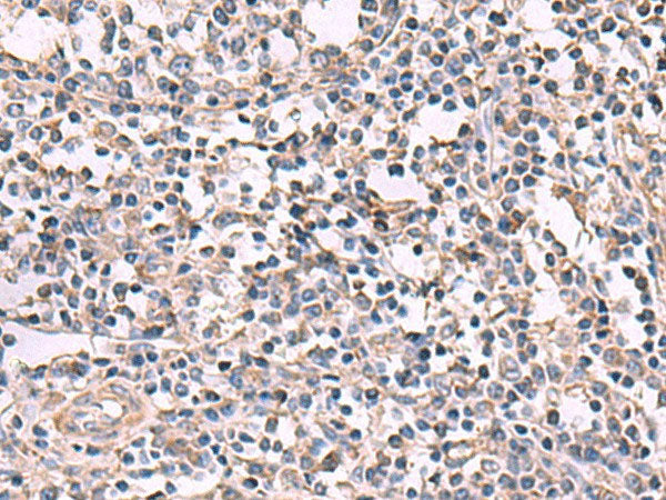 KCNK18 Polyclonal Antibody Reactivity Human
