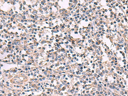 KCNK18 Polyclonal Antibody Reactivity Human