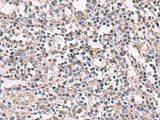 KCNK18 Polyclonal Antibody Reactivity Human