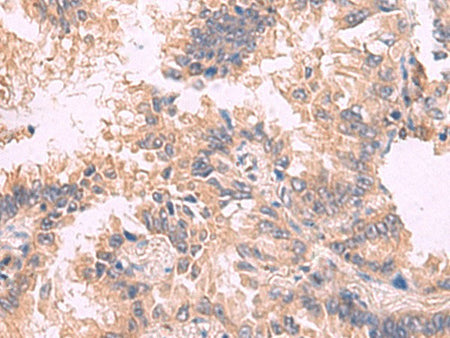 TJP1 Polyclonal Antibody