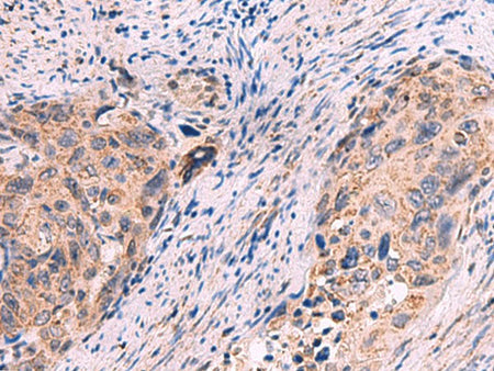 KCNN1 Polyclonal Antibody Reactivity Human