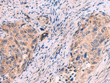 KCNN1 Polyclonal Antibody Reactivity Human