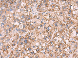 KCNN1 Polyclonal Antibody Reactivity Human