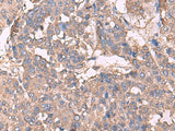 KCNN2 Polyclonal Antibody Reactivity Human