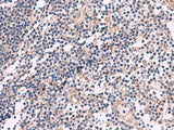 KCNN3 Polyclonal Antibody Reactivity Human