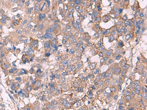 KCNN3 Polyclonal Antibody Reactivity Human