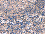 KCNT1 Polyclonal Antibody