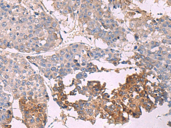 NIPSNAP1 Polyclonal Antibody Reactivity Mouse