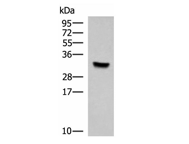 KCTD7 Polyclonal Antibody Reactivity Rat
