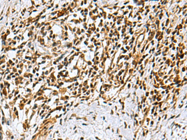 KDM2B Polyclonal Antibody Reactivity Mouse
