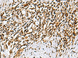 KDM2B Polyclonal Antibody Reactivity Mouse