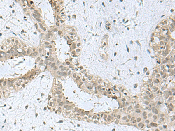 KDM3B Polyclonal Antibody Reactivity Mouse