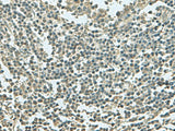 KRT36 Polyclonal Antibody Reactivity Human