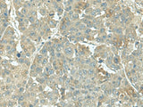 KRT36 Polyclonal Antibody Reactivity Human