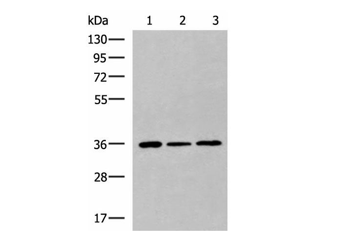 KHK Polyclonal Antibody Reactivity Mouse