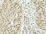 KHSRP Polyclonal Antibody Reactivity Mouse