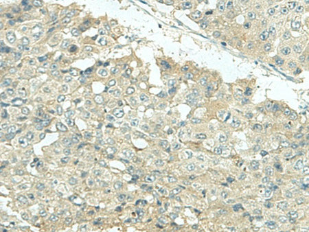 KIR2DL5A Polyclonal Antibody Reactivity Human
