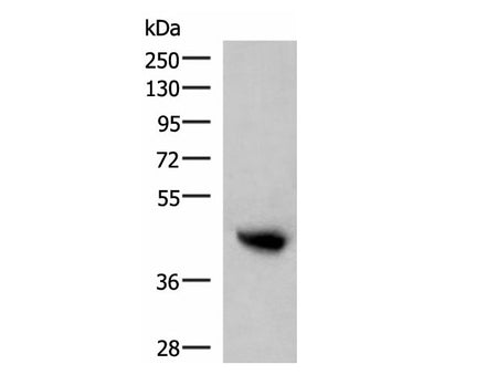 KIR2DL5A Polyclonal Antibody Reactivity Human