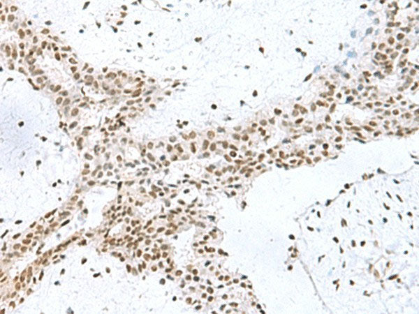 PUM3 Polyclonal Antibody Reactivity Human
