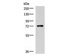 PUM3 Polyclonal Antibody Reactivity Human