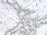 PCLAF Polyclonal Antibody Reactivity Human