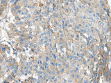 KIAA0556 Polyclonal Antibody Reactivity Human