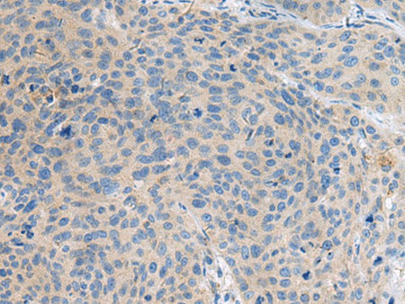 KIAA0556 Polyclonal Antibody Reactivity Human