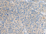 KIAA0556 Polyclonal Antibody Reactivity Human