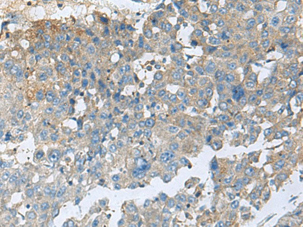 CEMIP Polyclonal Antibody Reactivity Mouse