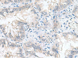 CAMSAP3 Polyclonal Antibody Reactivity Mouse