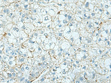 SHTN1 Polyclonal Antibody Reactivity Human