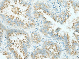 SHTN1 Polyclonal Antibody Reactivity Human