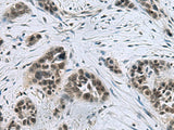 CCAR2 Polyclonal Antibody Reactivity Mouse