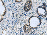 CCAR2 Polyclonal Antibody Reactivity Mouse