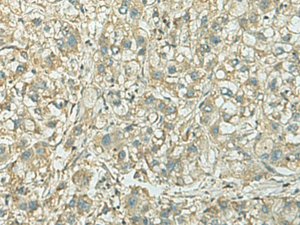 KIF21B Polyclonal Antibody Reactivity Rat