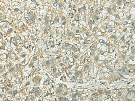 KIF21B Polyclonal Antibody Reactivity Rat