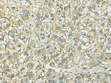 KIF21B Polyclonal Antibody Reactivity Rat