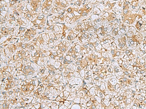 FERMT1 Polyclonal Antibody