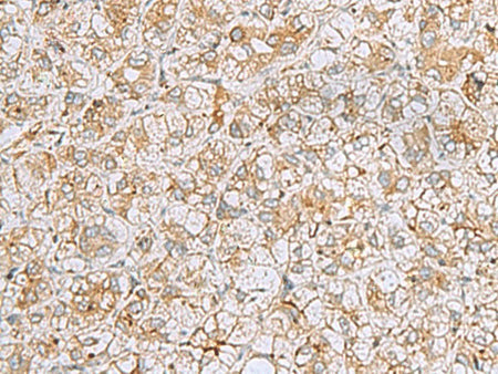 FERMT1 Polyclonal Antibody