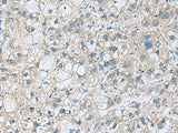 KCNJ2 Polyclonal Antibody Reactivity Human