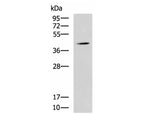 SPI1 Polyclonal Antibody