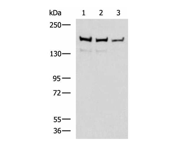ROCK2 Polyclonal Antibody