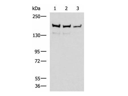 ROCK2 Polyclonal Antibody