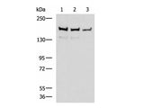 ROCK2 Polyclonal Antibody