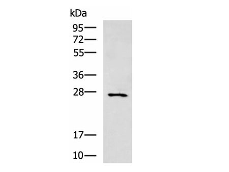 CIDEC Polyclonal Antibody Reactivity Human