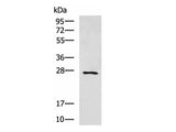 CIDEC Polyclonal Antibody Reactivity Human