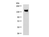 CEACAM1 Polyclonal Antibody Reactivity Human