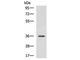 IBSP Polyclonal Antibody Reactivity Mouse