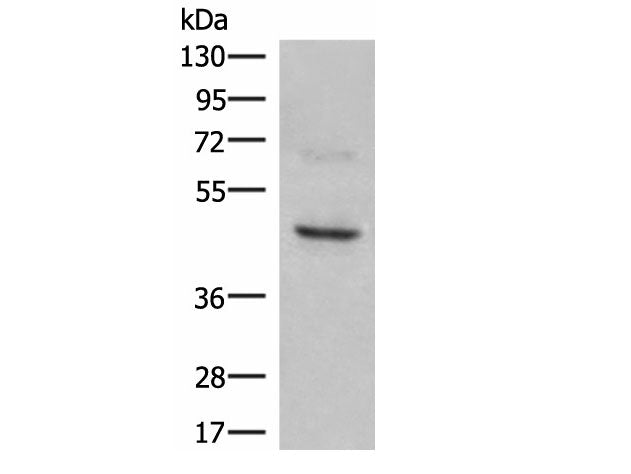 NCR1 Polyclonal Antibody Reactivity Human